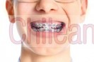 urgencia dental, ortodoncia, carillas dentales, limpieza, dentista