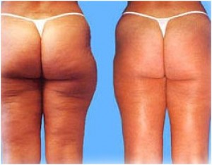 Claudia Gallo Anuncios gratis en Providencia |  Masaje Reductivo,drenaje post operatorio,ultrasonido, Medicina ayurveda,biotipos