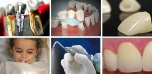 Clinica Dental Alvarez Anuncios gratis en Puerto Montt |  Dentista en Puerto Montt - www.clinicadentalalvarez.cl, Implantolog&iacute;a, protesis fijas, Odonotopediatr&iacute;a, limpieza dental, Urgencia