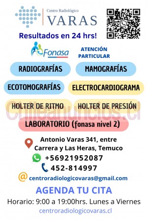 Cr varas spa Anuncios gratis en Temuco |  Traumatologo ecografia, radiografia, mamografia, laboratorio, holter, electrocardiograma , Traumatologo temuco, imagenologia, ecografia, radiografia, mamografia